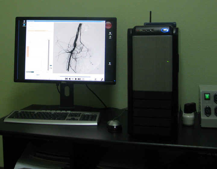 Одно-мониторная рабочая DICOM станция Michelangelo на базе PC. One-monitor DICOM workstation Michelangelo (PC based).