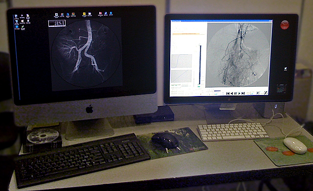 Двух-мониторная рабочая DICOM станция Michelangelo (iMac + LED Cinema). Dual-monitor DICOM workstation Michelangelo (iMac + LED Cinema).