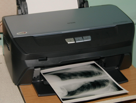 Профессиональная печать на рабочей DICOM станции Michelangelo. Professional print on DICOM workstation Michelangelo